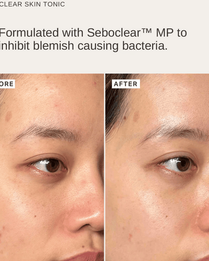 Alpha-H Blemish Duo