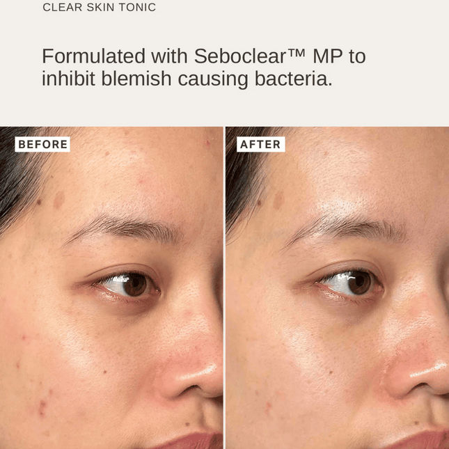 Alpha-H Blemish Duo