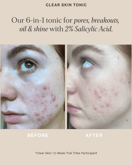 Alpha-H Clear Skin Tonic 100ml