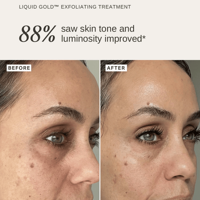 Alpha-H Exfoliate & Protect Duo