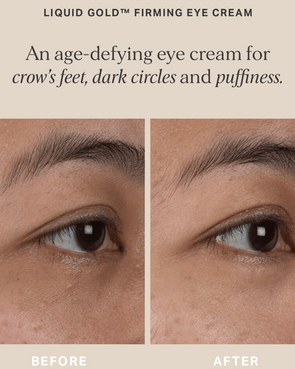 Alpha-H Liquid Gold Firming Eye Cream 15ml
