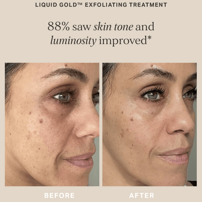Alpha-H Liquid Gold with 5% Glycolic Acid - 100ml