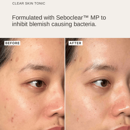 Alpha-H Peri & Menopause Skin Kit