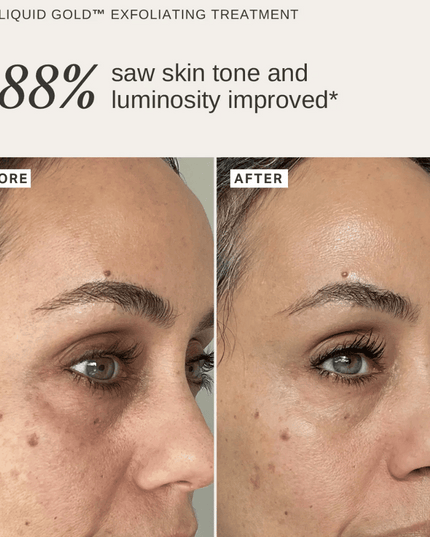 Alpha-H Plump & Glow Duo