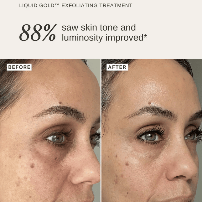 Alpha-H Plump & Glow Duo