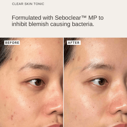 Alpha-H Pore-Refining Essentials