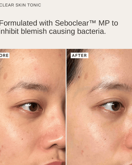 Alpha-H Pore-Refining Essentials