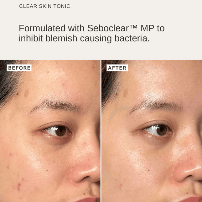 Alpha-H Pore-Refining Essentials