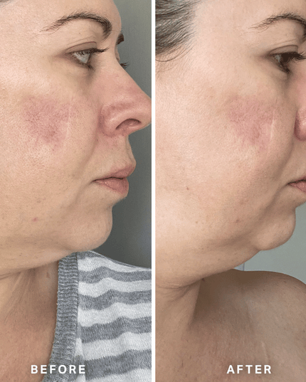 Alpha-H Vitamin A Serum 10ml
