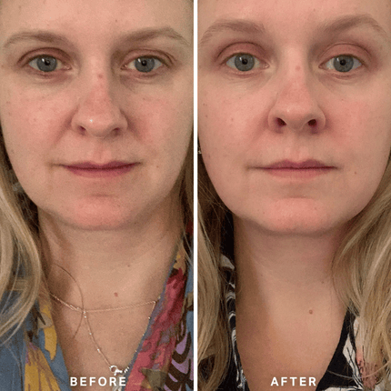 Alpha-H Vitamin A Serum 10ml