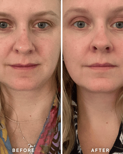Alpha-H Vitamin A Serum 10ml