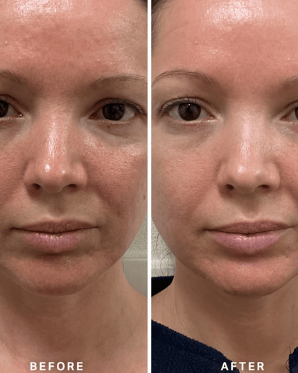 Alpha-H Vitamin B Serum 25ml