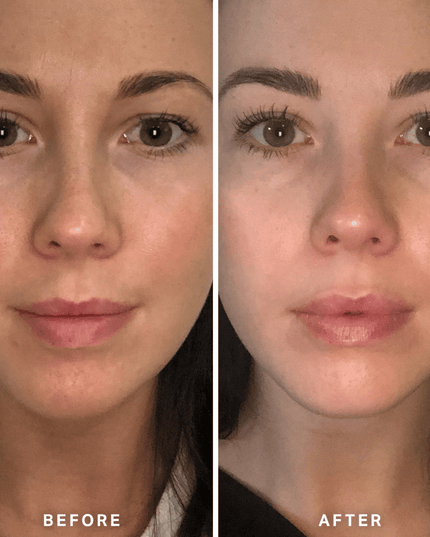 Alpha-H Vitamin B Serum 25ml