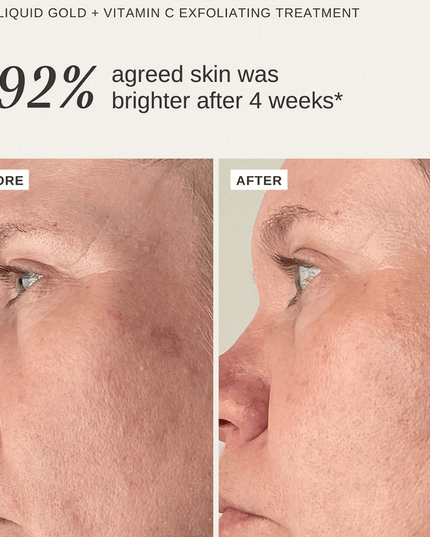 Alpha-H Vitamin C Duo