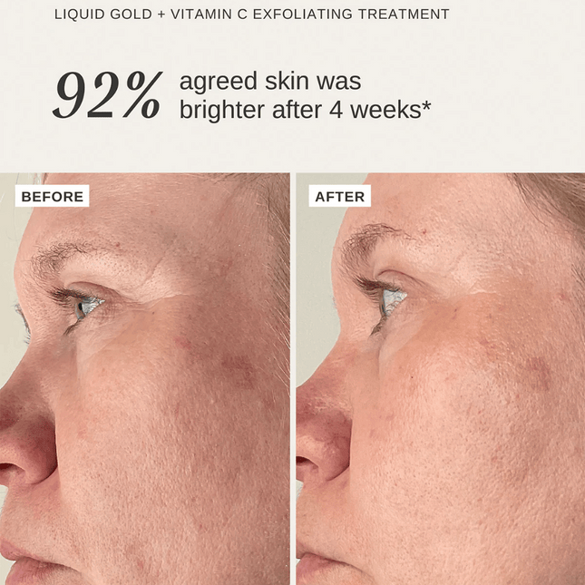 Alpha-H Vitamin C Duo