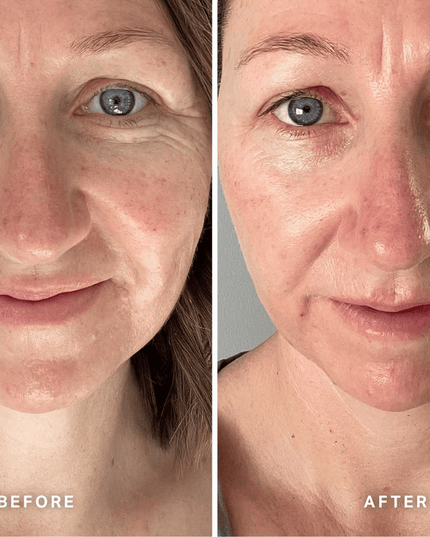 Alpha-H Vitamin E Serum 10ml