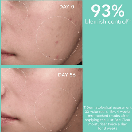 Apivita Just Bee Clear Blemish Control Mattifying Moisturizer 40ml