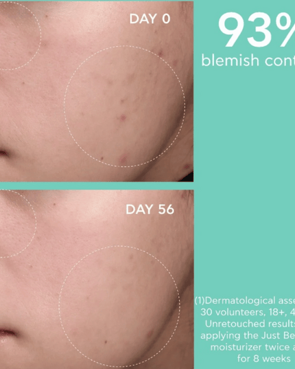 Apivita Just Bee Clear Blemish Control Mattifying Moisturizer 40ml