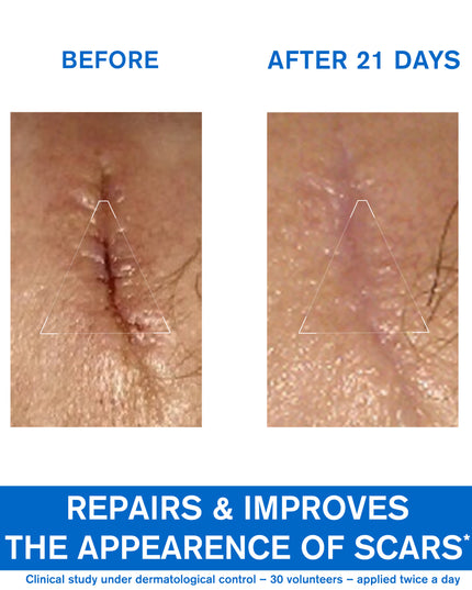 Uriage Bariederm Repairing Cica Cream, Copper And Zinc 40ml