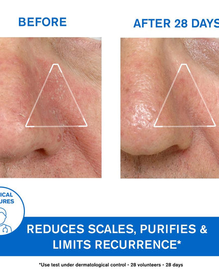 Uriage D.S. Regulating Emulsion, Irritation, Redness, Scales 40ml