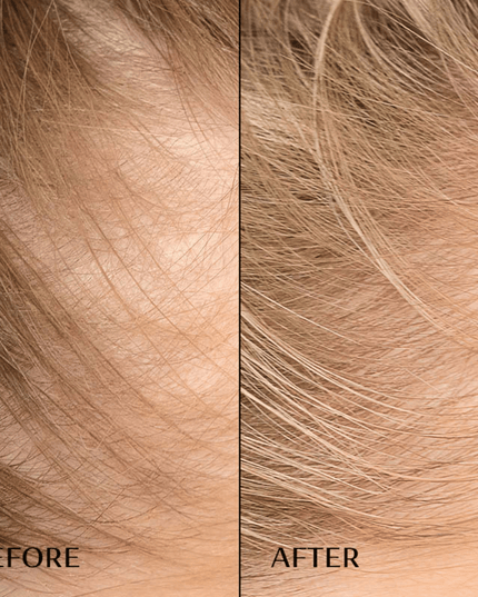 M2 BEAUTÉ Hair Activating Serum 30ml