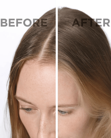 Phyto SOFTNESS Dry Shampoo 75ml