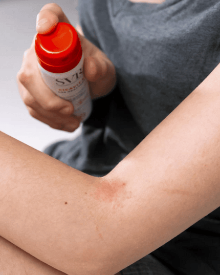 SVR CICAVIT+ SOS ITCHING SPRAY  40ML