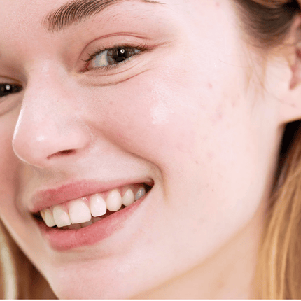 SVR Sebiaclear SPF50 Cream 40ml