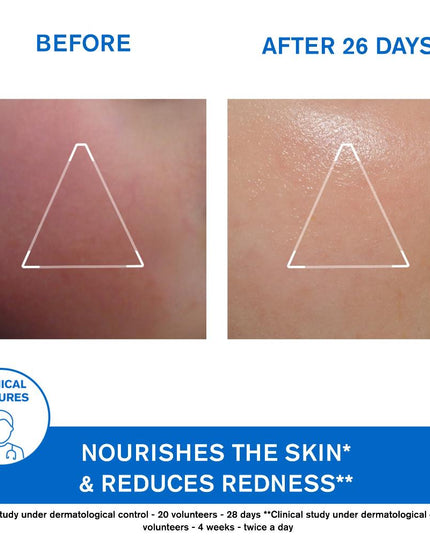 Uriage Xemose Nourishing Face Cream 40ml